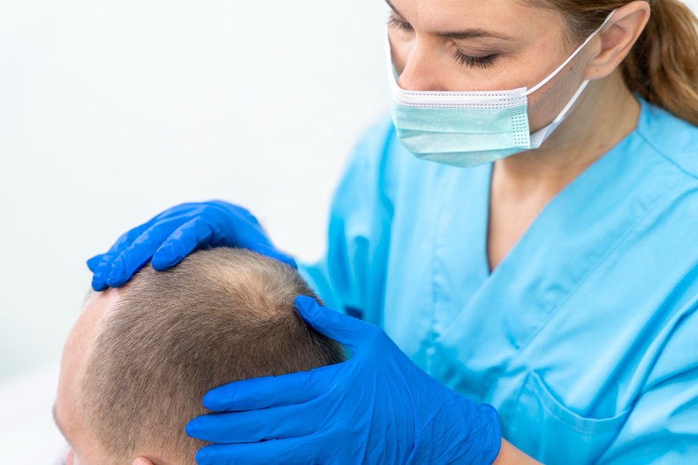 FUE hair transplant