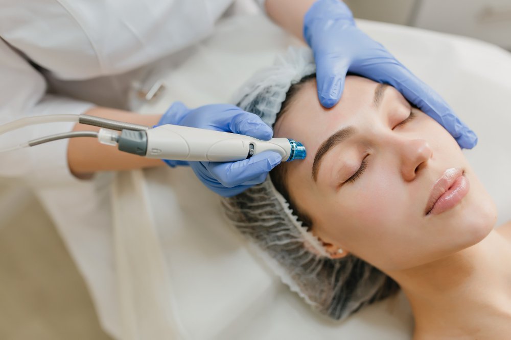 Microneedling